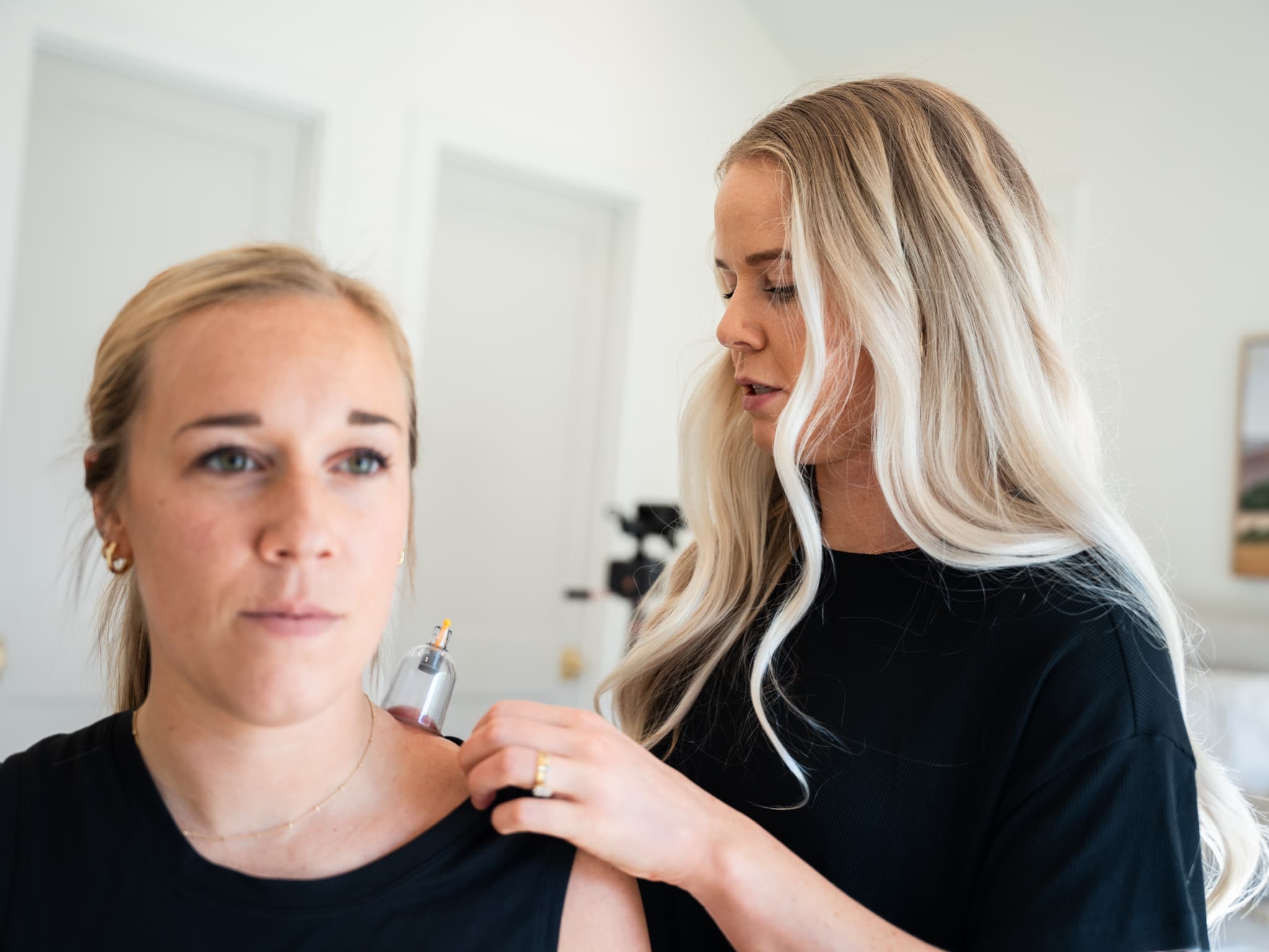 Cupping therapy demonstration